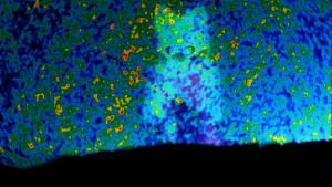 The cosmic microwave background.