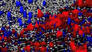 A biopsy sample colored by biomarkers. These can be identified by the same tools used in astronomy.