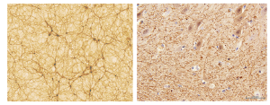 A simulations of cosmic filaments (left) compared with a section of human cerebellum (right).